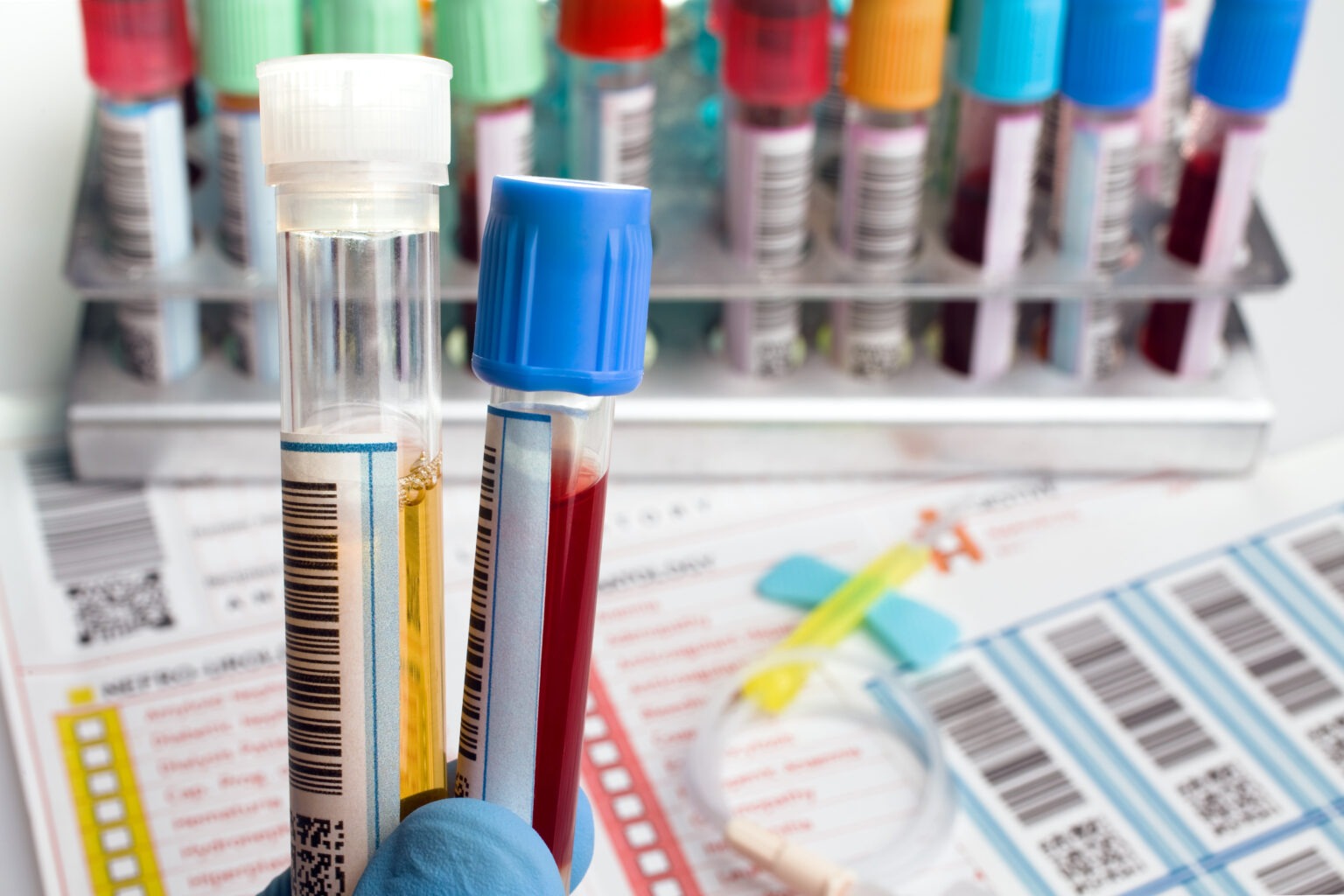 Wiech Lab Become a Patient at Advanced Practice Health Institute – Our Process